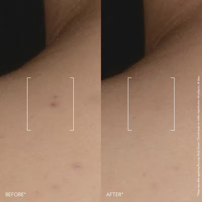 Biotherm Biocorps Anti-Bump Body Serum