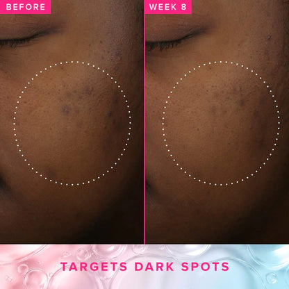 Farmacy Mini Brighten Up 3% TXA Dark Spot Toner with Azelaic Acid 50mL